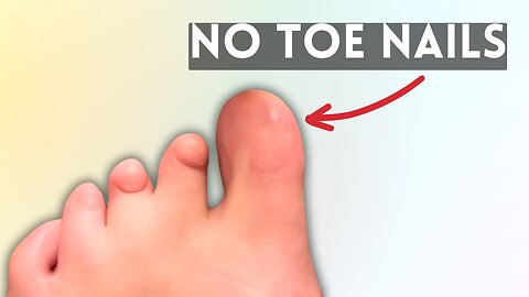 I was born without toe nails - Doctor was stunned