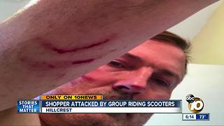 Man beaten by group riding scooters