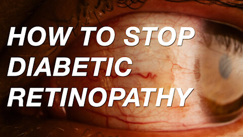 Solving Diabetic Retinopathy