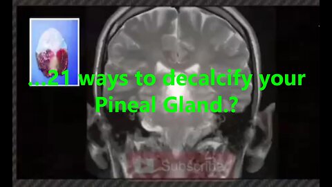 …21 ways to decalcify your Pineal Gland?