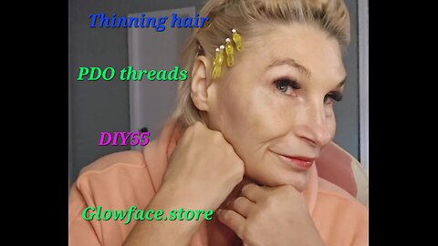 Alopecia Hair loss PDO threads Glowface.store DIY55