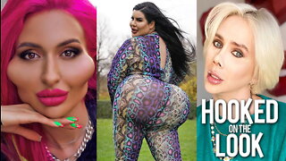 5 Plastic Surgeries That Stunned The World | HOOKED ON THE LOOK