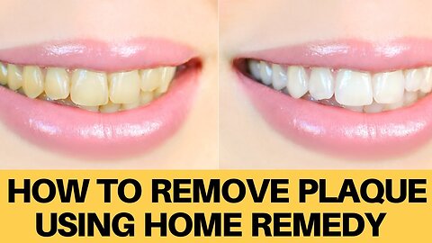 How to remove tartar or plaque using home remedy