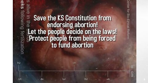 You need to Vote "YES" if you Live in Kansas! Tell everyone you know!! #valuethemboth