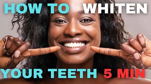 How to NATURALLY whiten your teeth in 5 MIN! (Teeth Whitening Kit in Description!)