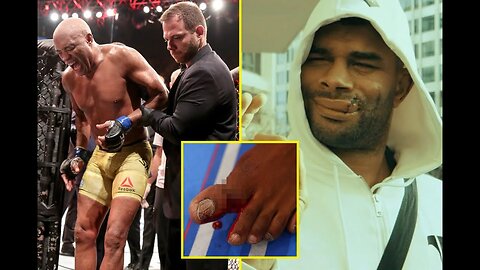 Worst Injuries in UFC History || Best KO's || Broken bones