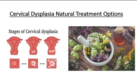 Cervical Dysplasia Natural Treatment Options