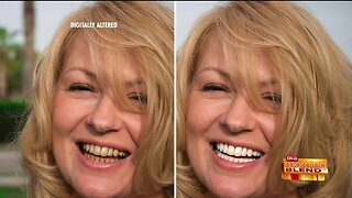 Get Your Confidence Back with a Whiter Smile