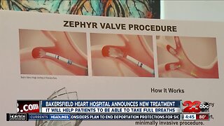 Bakersfield Heart Hospital announces new treatment for people with breathing problems
