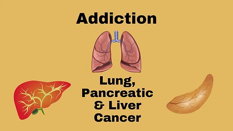 Addiction, Pancreatic and Lung Cancer