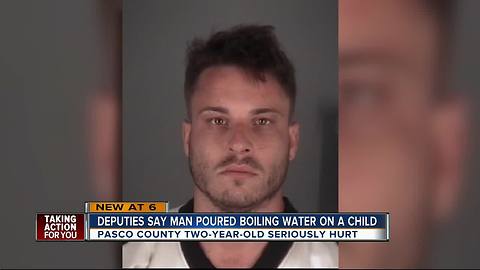 Dade City man admits to pouring scalding hot water on two-year-old child