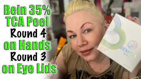 Bein 35% TCA Peel Round 4 on Hands and 3 on Eye Lids from Acecosm | Code Jessica10 saves you Money