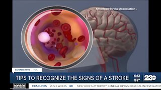 How to recognize the signs of a stroke