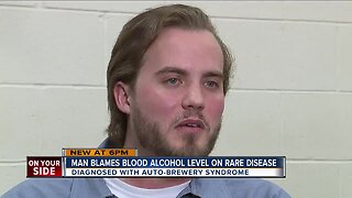 Man blames blood alcohol level on rare disease