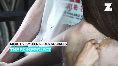 Mi activismo en redes sociales: The Skin Project