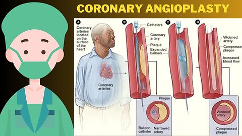 Coronary Angioplasty (Femoral Artery Access)