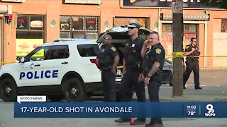 Police investigate Avondale shooting that injured 17-year-old