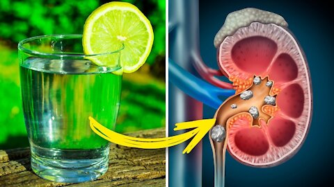 8 Health Problems You Can Cure With Lemon Juice (weight loss)