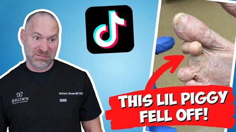 This Little Piggy Fell Off?! | TikTok Reacts