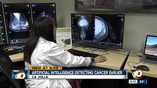 Artificial intelligence used for detecting cancer earlier