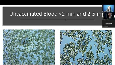 Synthetic Biological Life Forms – CDB, Morgellons, Live Blood Findings in Post C19 Injection Era