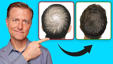 How to Regrow Your Hair (UPDATED VITAL INFO)