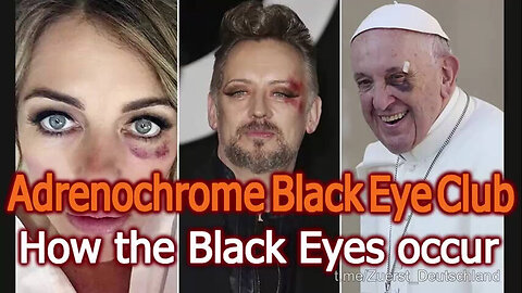 Adrenochrome Masonic Club (Panda Eyes and Black Eye Pedo)