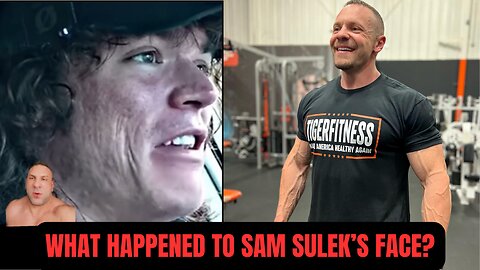 What Happened to Sam Sulek's Face?