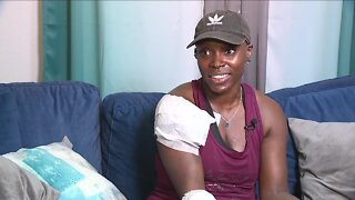 Hillsborough County mother suffers serious burns after a grilling accident