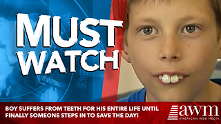Boy Who Has Been Bullied For Most Of His Life, Finally Gets Teeth Fixed. Can’t Stop Smiling