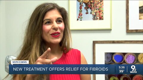 Local doctor brings revolutionary treatment for fibroids to Cincinnati Tri-State