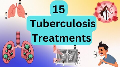 15 Tuberculosis treatments