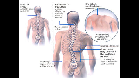 Back Pain Mapping Source Interventions Sun April 24th 2022