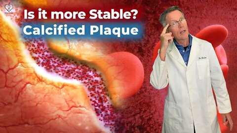 Does Calcified Plaque Really Reverse CV Risk from Soft Plaque?