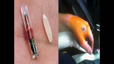 PETS MUST NOW BE MICROCHIPPED IN HOUSTON TEXAS; FREE CHIPS & FAILURE TO COMPLY WILL RESULT IN $100 FINES & MORE… UP NEXT MANDATORY HUMAN RFID CHIP MICROCHIP IMPLANTS.🕎 Revelation 13;15-18 “no man might buy or sell, save he that had the mark