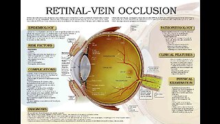 20,000% Increase in Retinal Eye Damage Following the Thingy