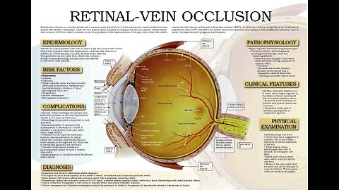 20,000% Increase in Retinal Eye Damage Following the Thingy