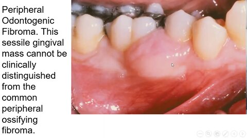 oral pathology L9 (mesenchymal origin tumors)