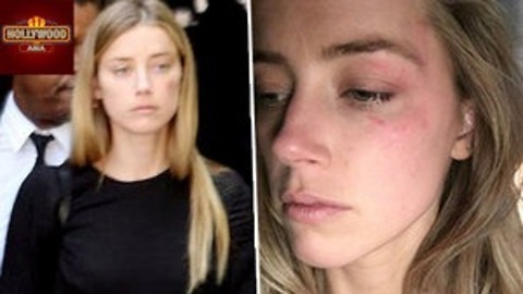 Amber Heard Claims 'Domestic Violence' Against Johnny Depp