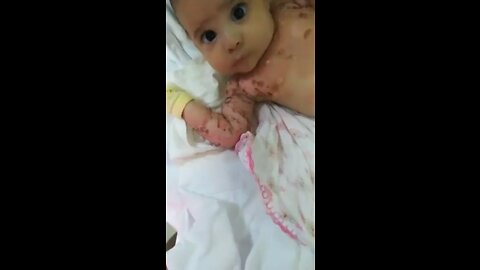 sick 1 month old baby born to HAXD GMO MUTANT MOM