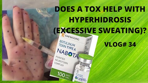 DIY HYPERHIDROSIS TREATMENT AT HOME! VLOG#34 #TOX #hyperhidrosis #nabota