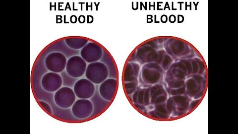 51. MMS: What Chlorine Dioxide is ACTUALLY doing in your blood. (Microscope Views)
