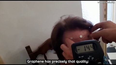 They are injecting graphene oxide as an adjuvant in vaccines