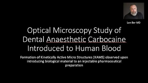 Study of Dental Anaesthetic Carbocaine Introduced to Human Blood (Part 1)