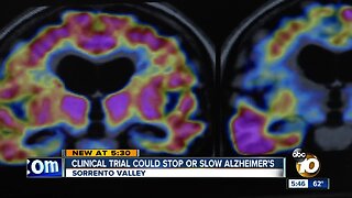 Clinical trial hopes to stop or slow Alzheimer's disease in patients