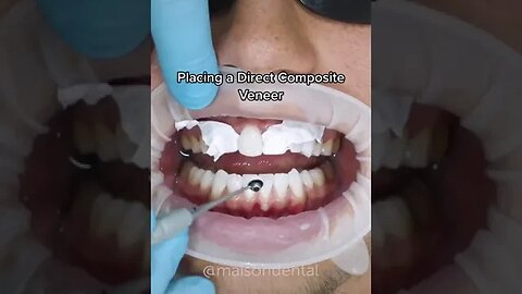 Dental And Teeth Hygiene