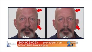 Feel and look younger with Plexaderm