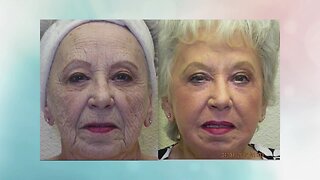 WOW! Look years younger with ONE treatment from Advanced Image Med Spa