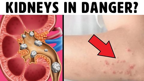 12 Signs Your Kidneys Are Screaming For Help