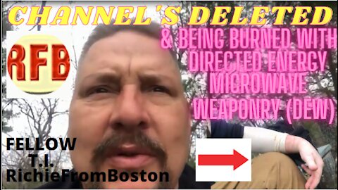 RichieFromBoston being TARGETED INDIVIDUAL - Channels are Delete, Being Burned with DEW Scalar Wave